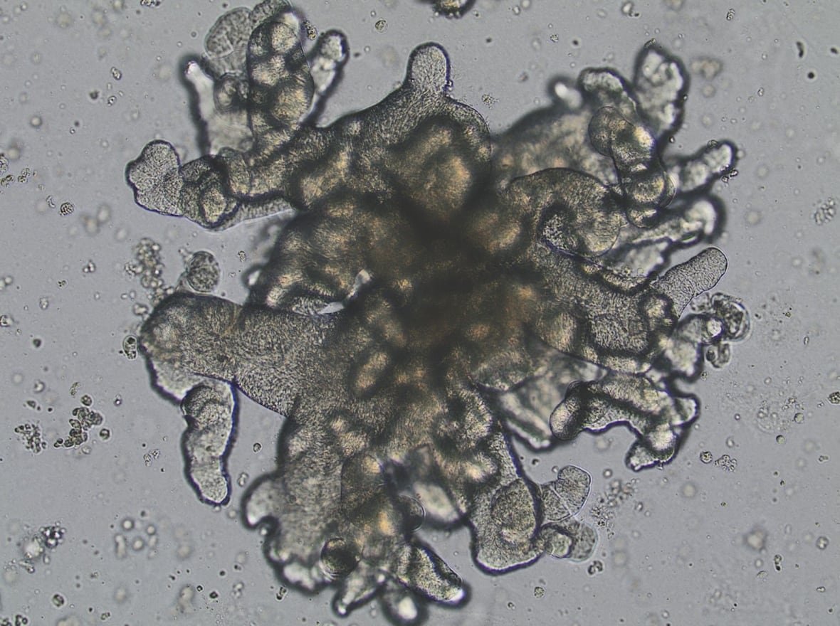 human-mini-gut-growing-in-cell-culture Cell culture of a human mini-gut with amorphous brown bubbles inside.