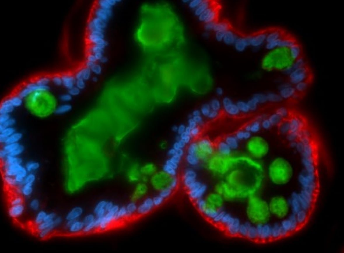 mini-gut Microscopic images of a human 3D minigut stained to show mucus (green), epithelial cells (red) and their nuclei (blue).