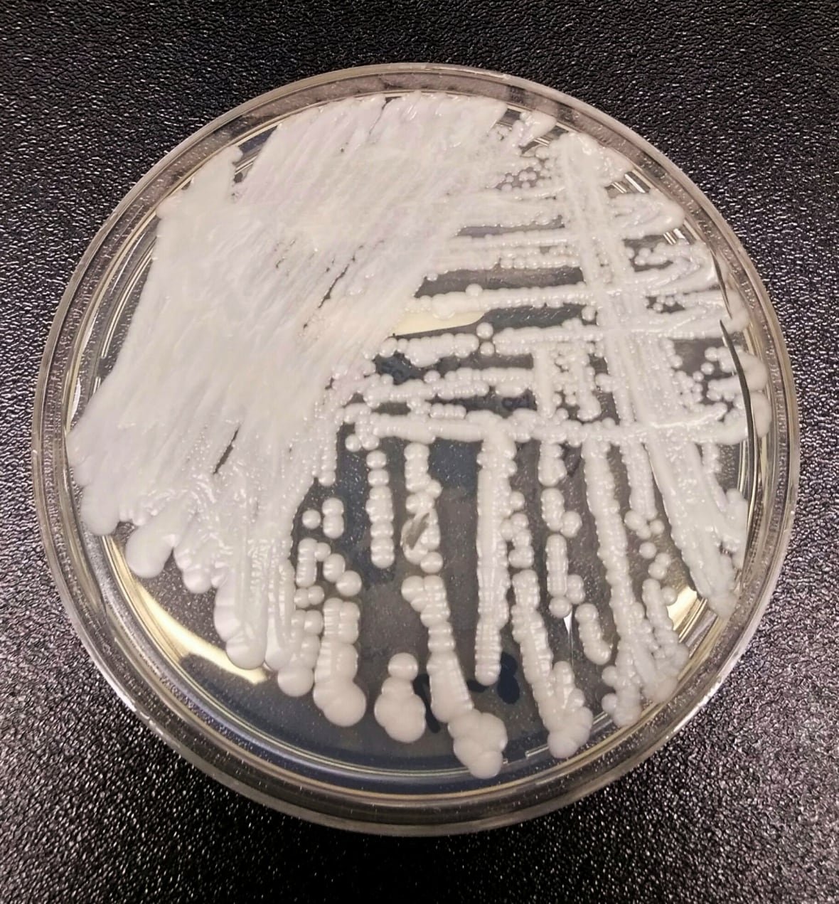 usa-health-superbug A strain of Candida auris cultured in a petri dish at the Centers for Disease Control and Prevention (CDC).